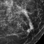 Fonte: Jmarchn via Wikimedia Commons